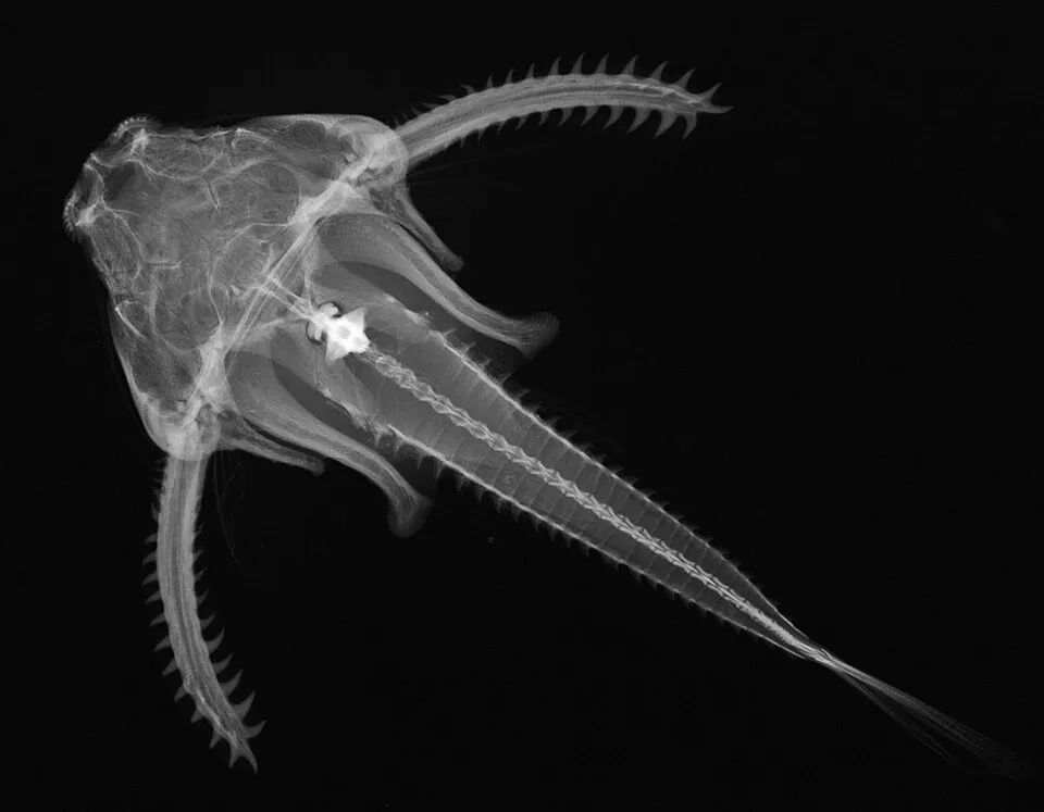 Physopyxis lyra, X-ray image